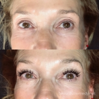 lash 170 small