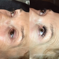 lash 172 small