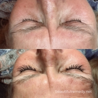 lash 181 small