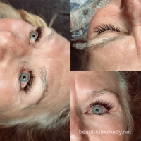 lash 183 small